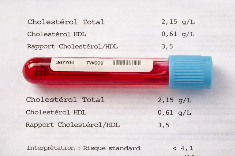 échantillon de sang pour une analyse de prise de sang afin de déceler du cholesterol.