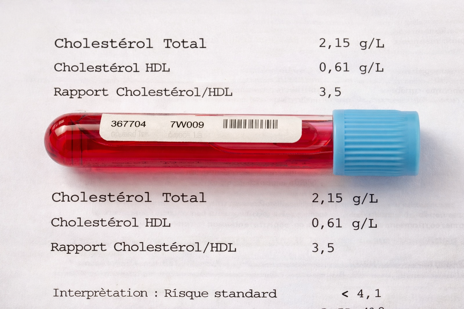 échantillon de sang pour une analyse de prise de sang afin de déceler du cholesterol.